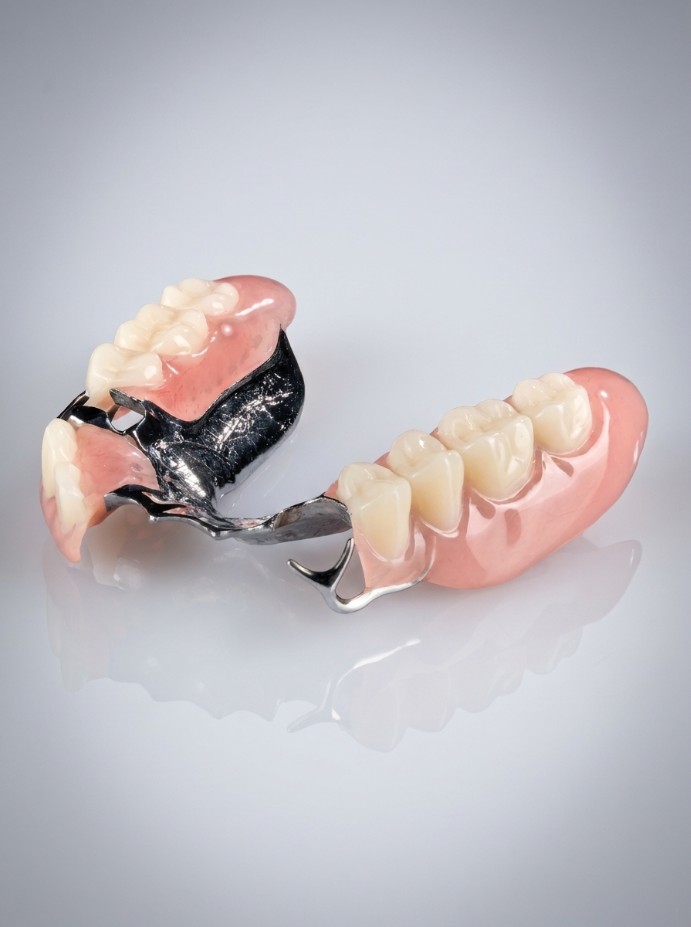Partial Dentures (Removable)